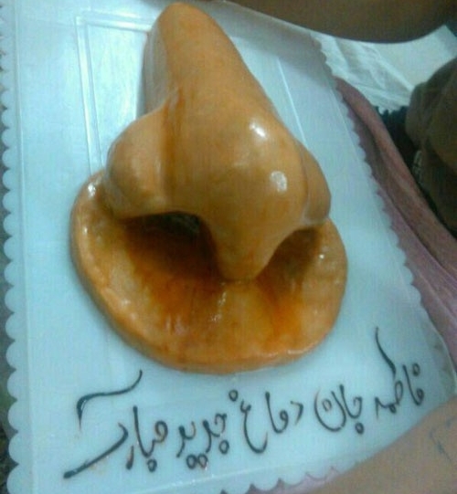 کیک دماغ! به مناسبت عمل دماغ!/عکس