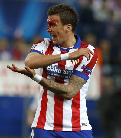 عکس: خون و خونریزی در دربی مادرید