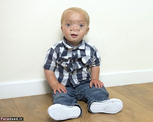 تصاویر/ پینوکیوی دنیای واقعی پیدا شد!