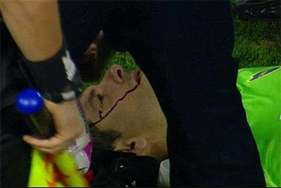 پرتاب سنگ دروازه بان را به خون کشید+ عکس