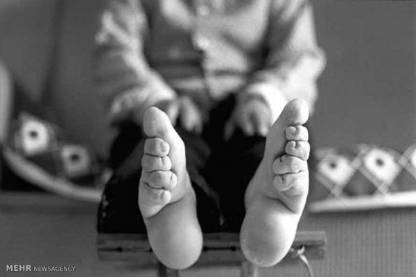 عکس هایی که دلتان نمی خواهد، ببینید!