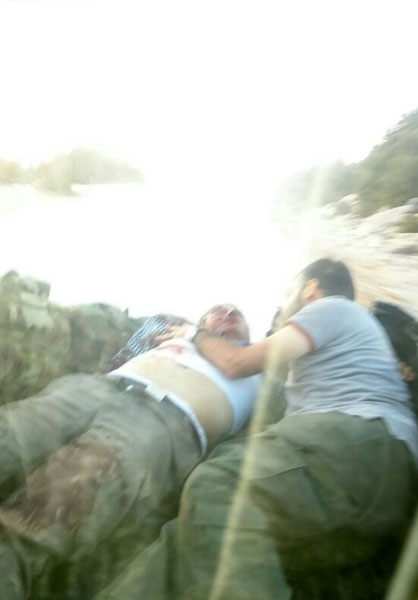 لحظه مجروحیت خبرنگار ایرانی/عکس