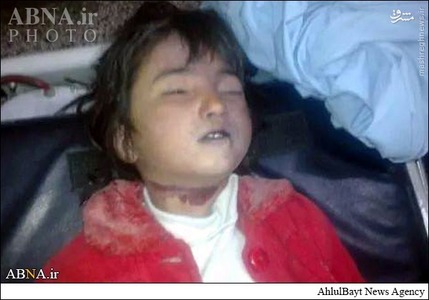 تصاویر/ذبح‌دخترشش‌ساله‌درشهر‌کویته