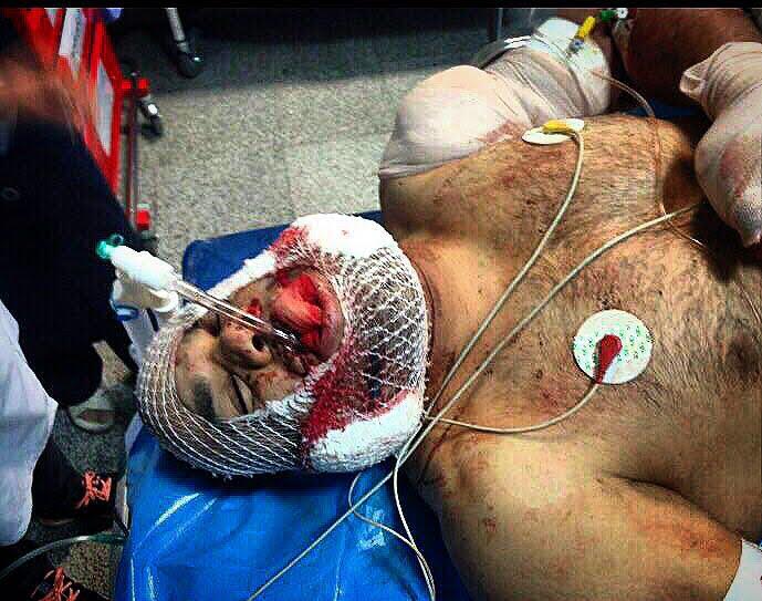 اولین عکس از فریدون قنبری قهرمان کشتی در بیمارستان!