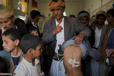 مرد یمنی جراحت کودکی که در بمباران 