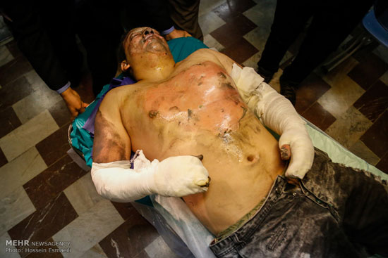 عکس: مصدومان چهارشنبه سوری در تهران