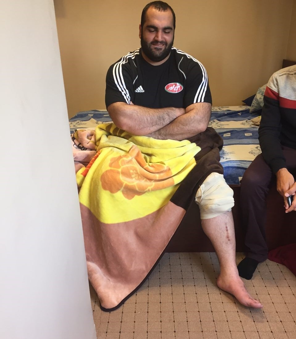 خبر بد برای وزنه برداری ایران؛ مصدومیت شدید دومین ستاره