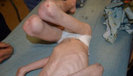 شکنجه کودک 5ساله توسط نامادری+تصاویر