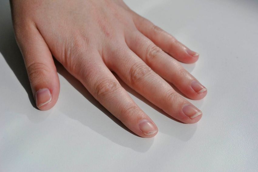 Ù†Ø´Ø§Ù†Ù‡ Ù‡Ø§ÛŒ Ø§Ø¨ØªÙ„Ø§ Ø¨Ù‡ Ø³Ø±Ø·Ø§Ù† Ù¾ÙˆØ³Øª