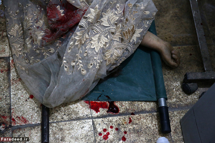 (تصاویر) کودکانی با رنج‌های بزرگ