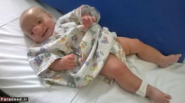 تصاویر/ پینوکیوی دنیای واقعی پیدا شد!