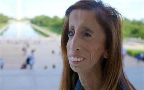 زشت ترین زن دنیا؛ قهرمان فیلم مستند! + عکس