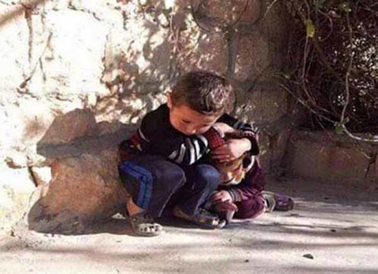 کودکی که سپر بلای خواهرش شد+ عکس