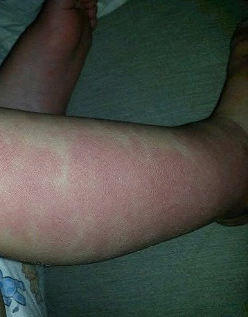 فداکاری جالب پدر و مادر دلسوز برای کودک بیمارشان! +تصاویر